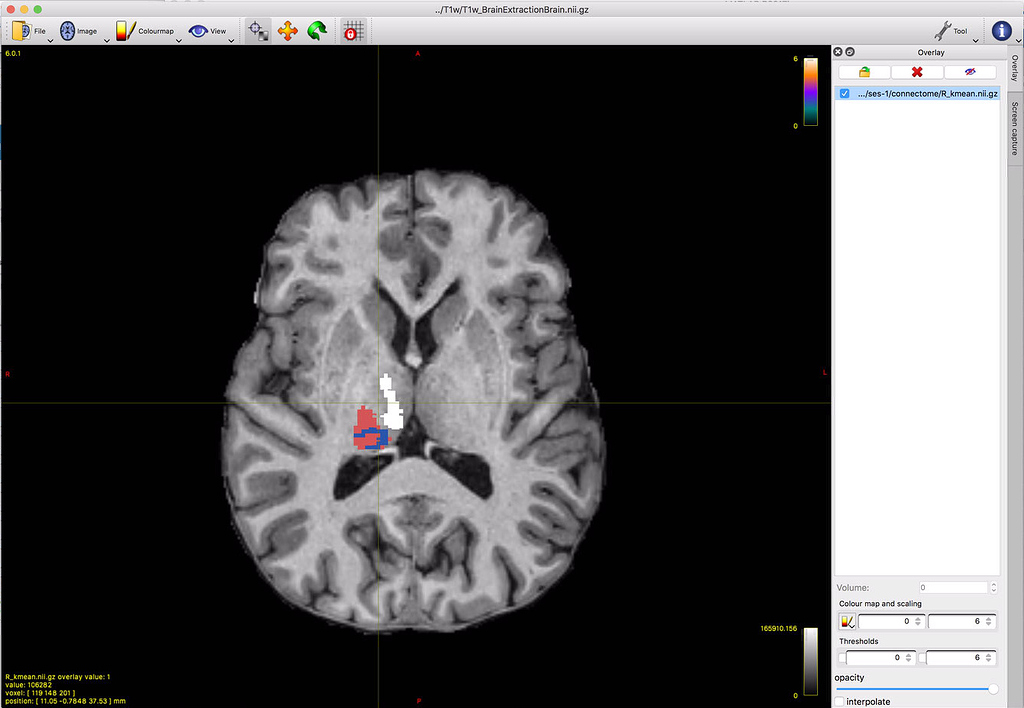 Overlay colourmap in mrview: value 1 not displayed. Any custum colour ...