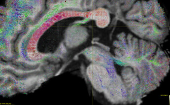 high-res_fod_sagittal