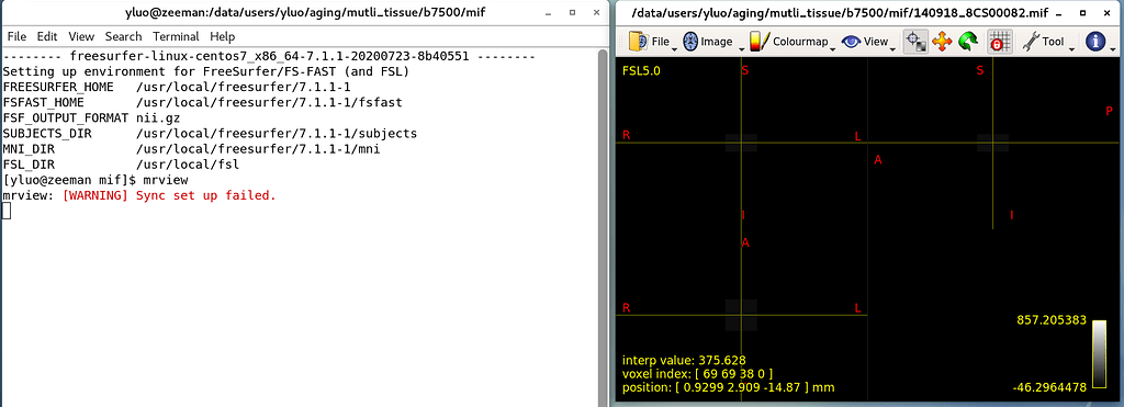mrview:[WARING] Sync set up failed - MRtrix3 Community