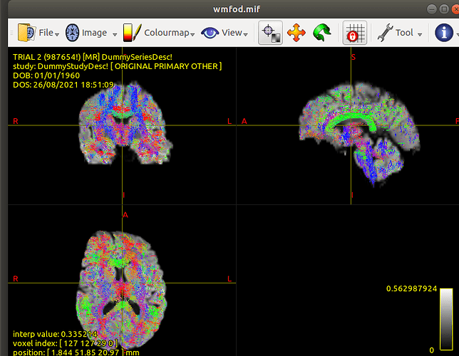 Shift_10k_ortho_view