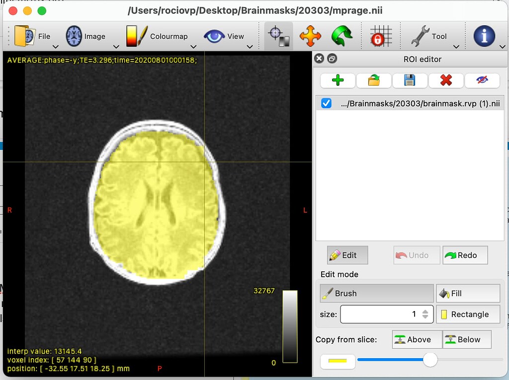 MRview ROI editor bug - Mask removed - Development - MRtrix3 Community