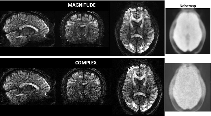 MPPCA_mag_vs_complex