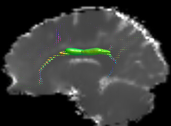 Output of tckmap