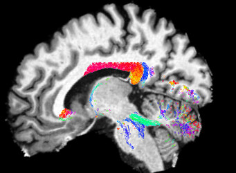 high-res_ifod2_vtk_sagittal