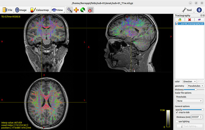 fig.1 tck&t1