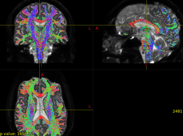 Screenshot from 2026-01-12 15-14-54